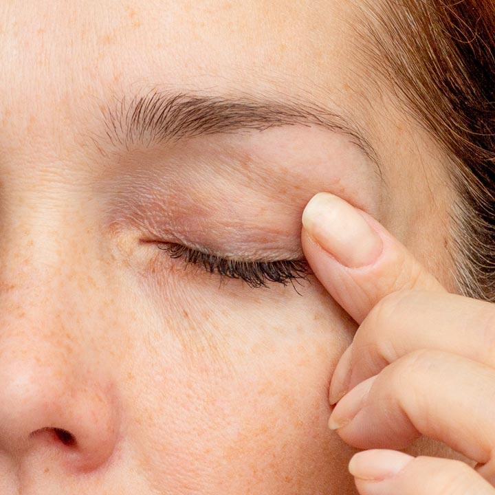 HR Plastic Sugery - Droopy eyelids - Eyelid bags - Loose excess eyelid skin What Can I do