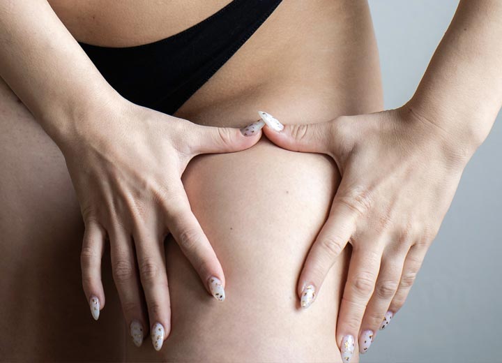HR Plastic Sugery Loose excess thigh - leg skin