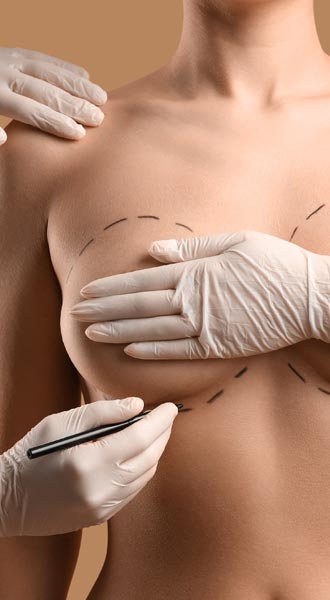 Breast Reduction surgery