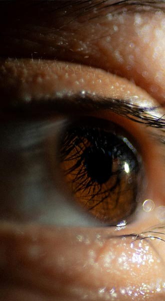 Eyelid Surgery