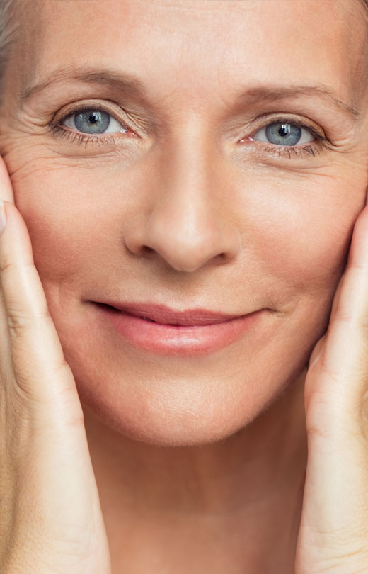 Facelift