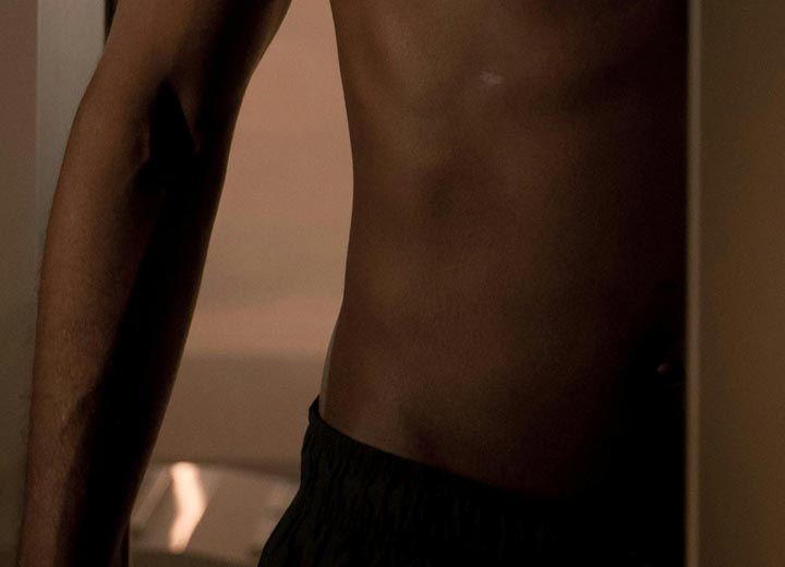 Liposuction for men
