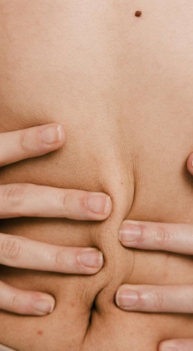 Mini Tummy Tuck Procedure