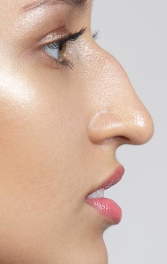 misshapen nose