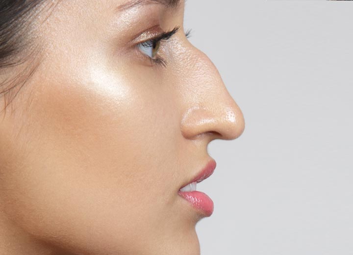 misshapen nose