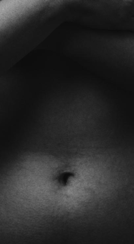 tummy tuck