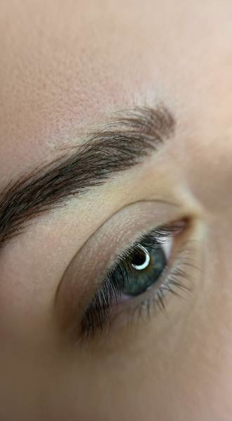 Brow Lift surgery