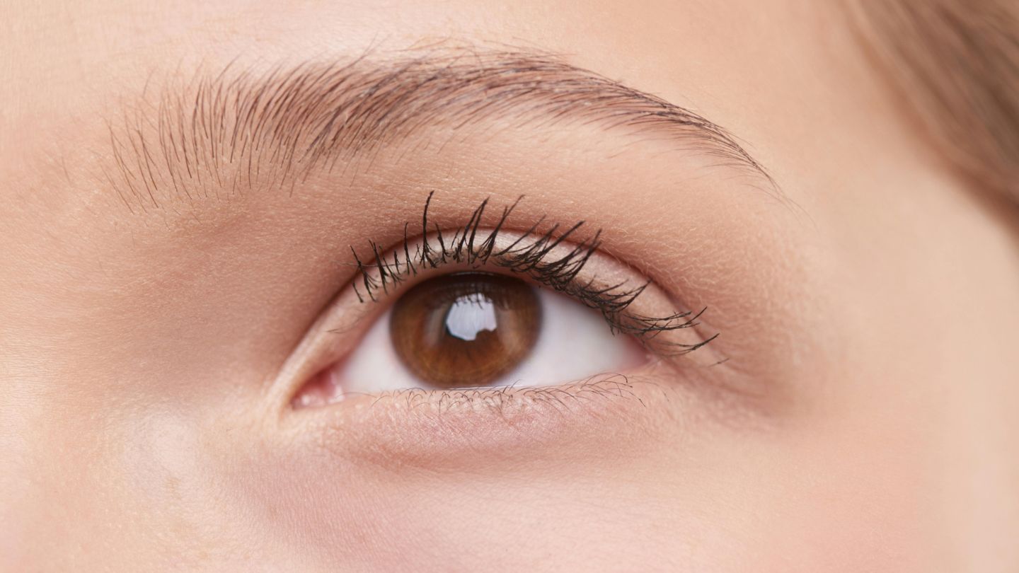 Brow Lift