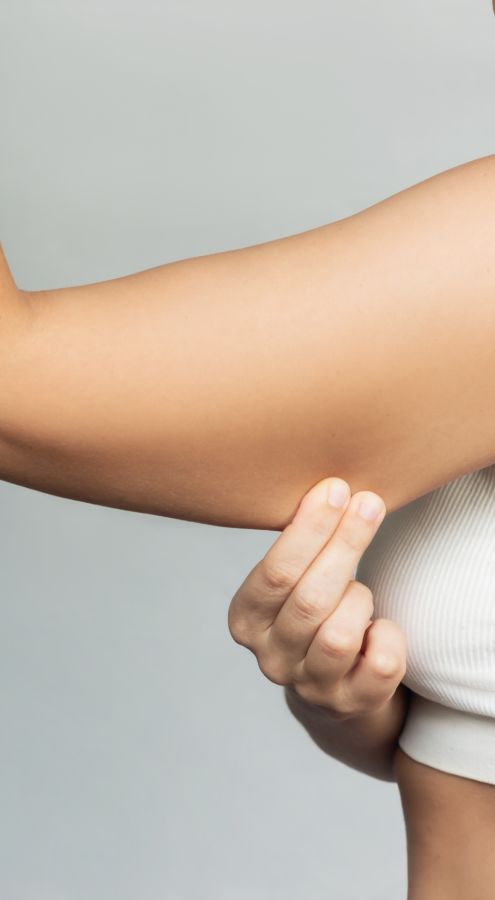 loose arm skin