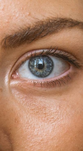 HR Plastic Surgery - Eyelid Surgery (Blepharoplasty) Causes