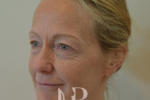 HR Plastic Surgery - Facelift patient before 3