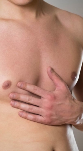 HR Plastic Surgery - Gynaecomastia Causes