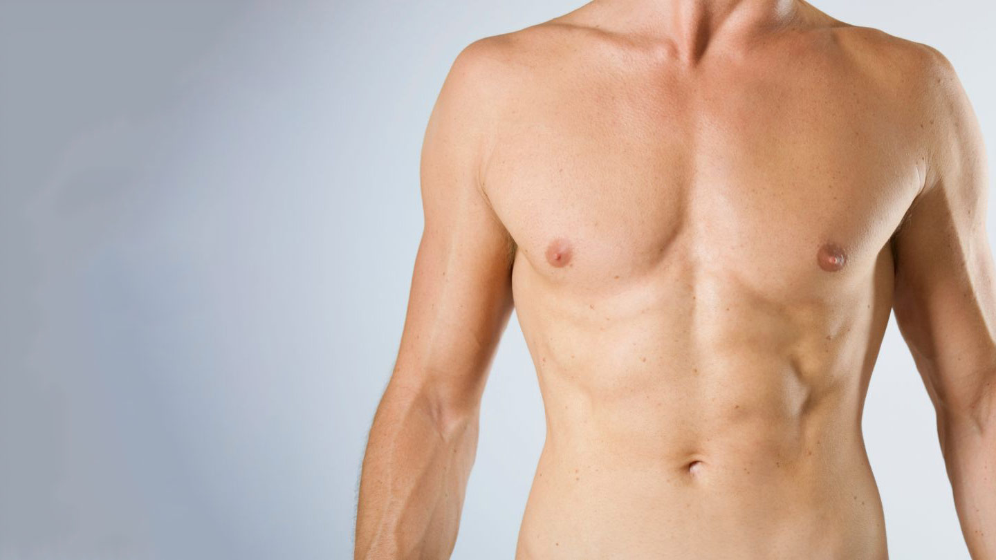 Gynecomastia surgery
