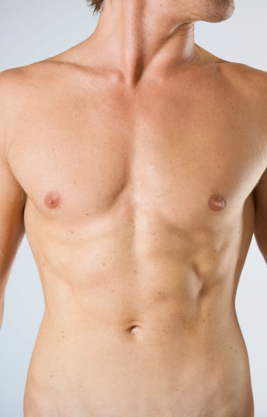 Gynecomastia surgery
