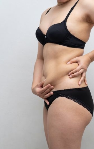 Abdominoplasty London