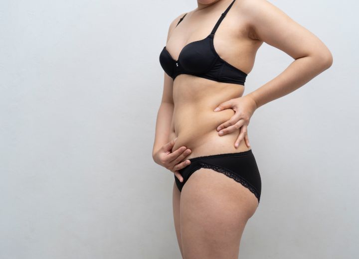 Abdominoplasty London