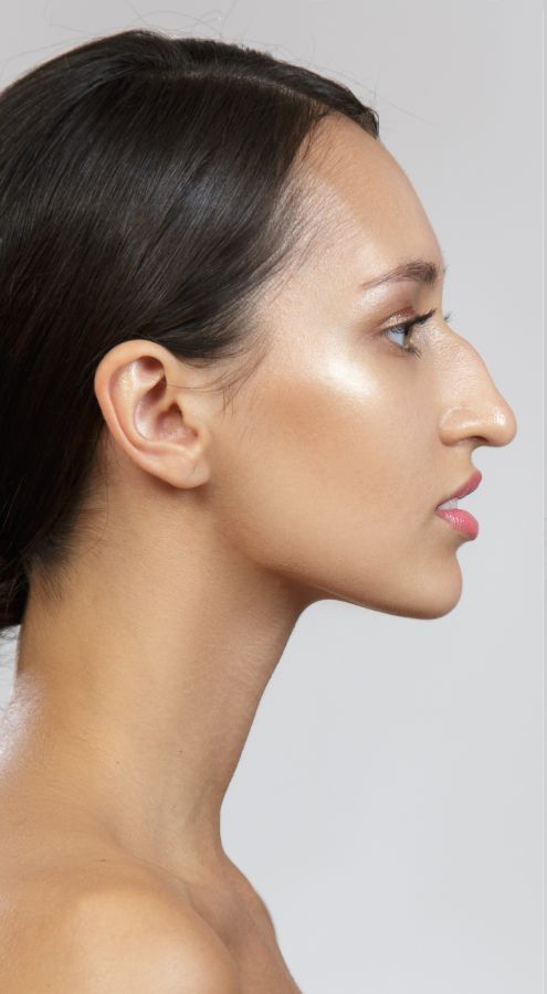 misshapen nose